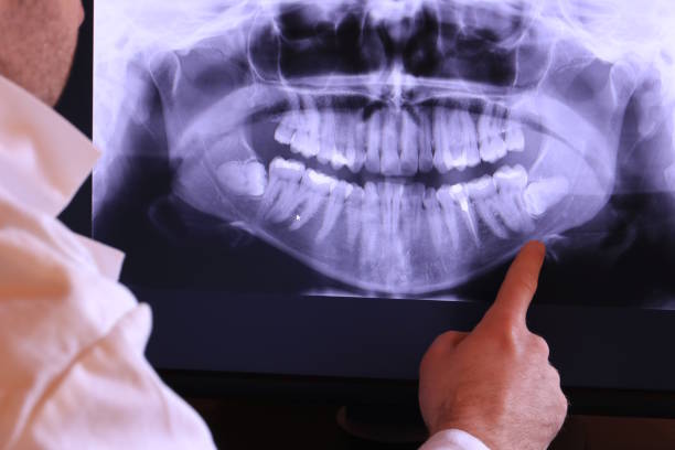 Best Holiday Emergency Dentist in Brogden, NC
