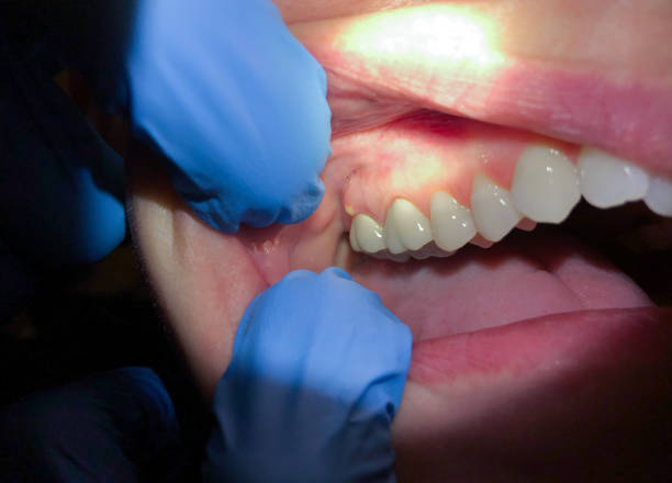 Best Weekend Emergency Dentist in Brogden, NC